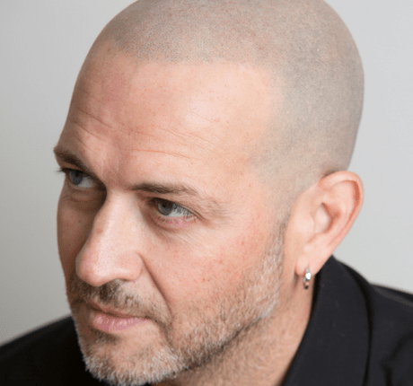 مزایا اسکالپ سر