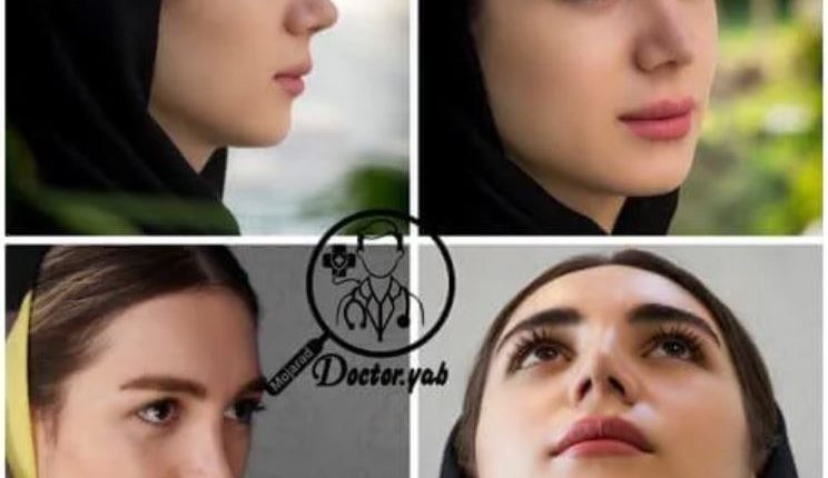 نمونه کار عمل بینی در شیراز