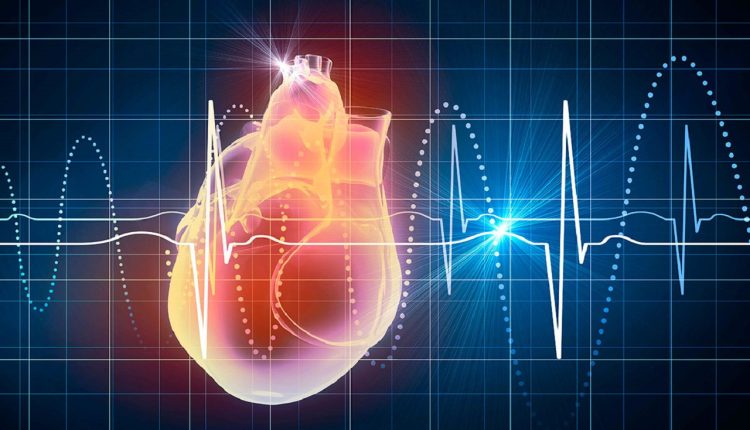 نوار قلب در اصفهان