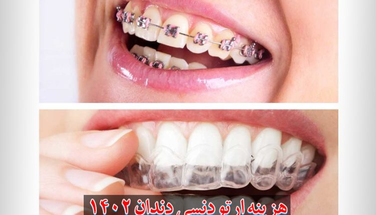قیمت ارتودنسی دندان