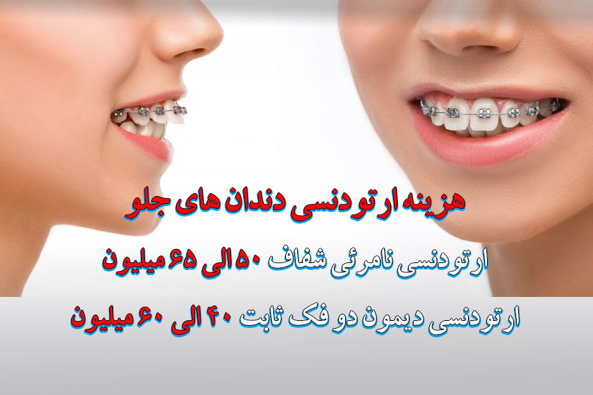هزینه ارتودنسی دندان 