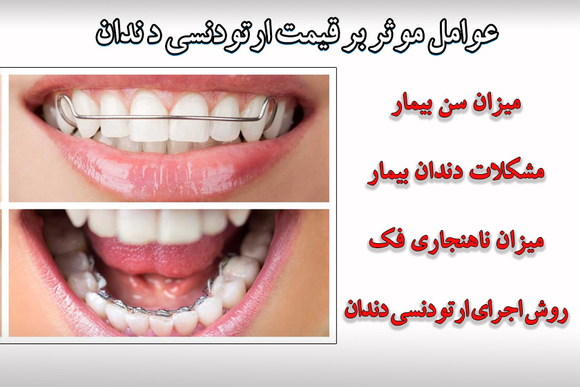 قیمت ارتودنسی دندان 1402