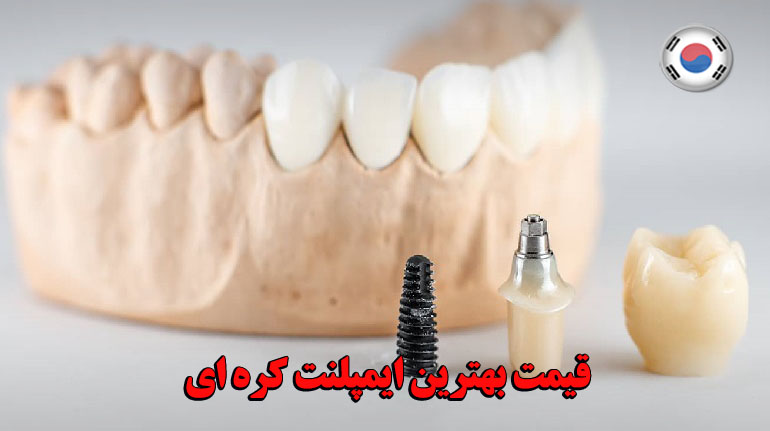 قیمت بهترین ایمپلنت کره ای
