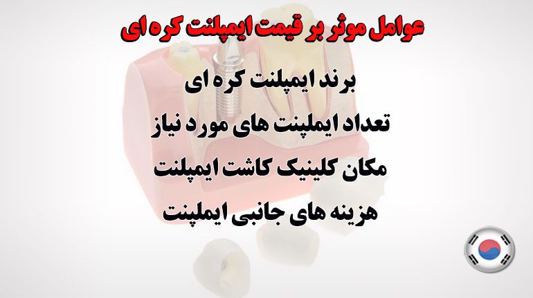 عوامل موثر بر قیمت ایمپلنت کره ای