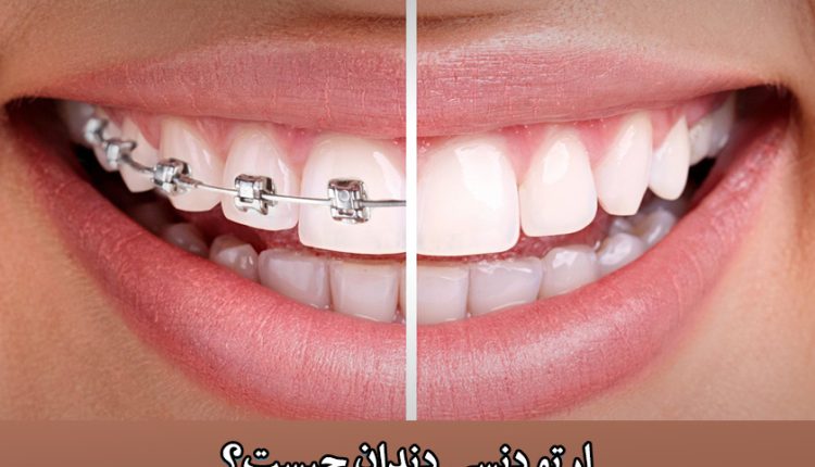 ارتودنسی  دندان چیست؟