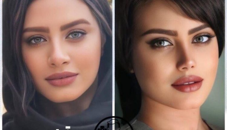 هزینه عمل بینی گوشتی