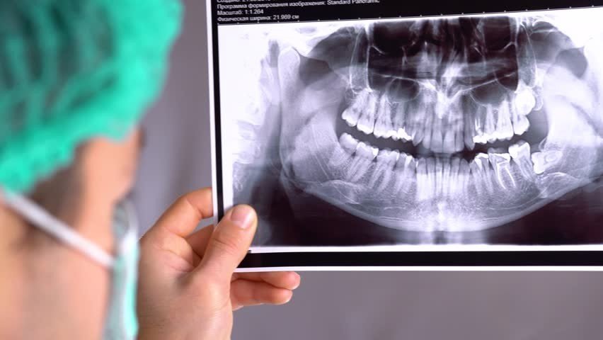 رادیولوژی دندان