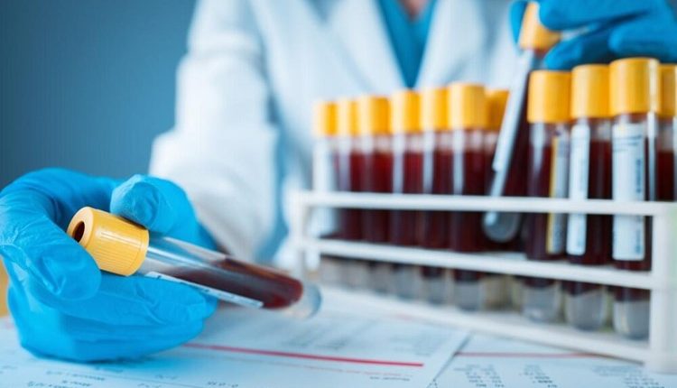 آزمایش خون و تحلیل نتایج