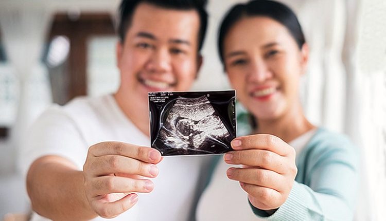 بارداری با آی یو آی