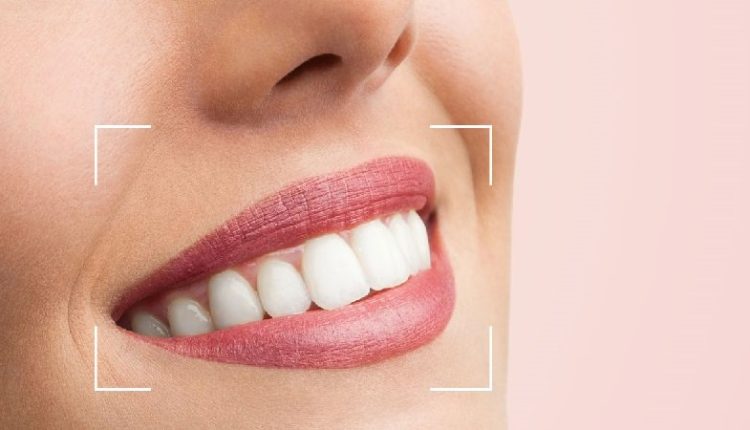 روش‌های جراحی لب برای طراحی لبخند