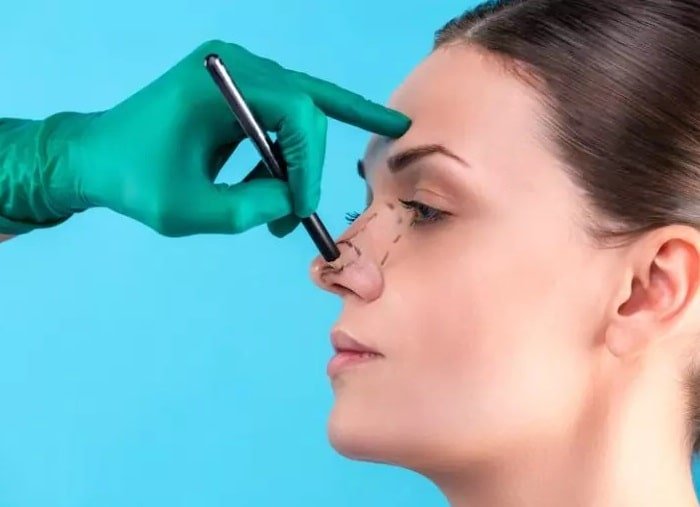 بهترین جراح بینی در کرج