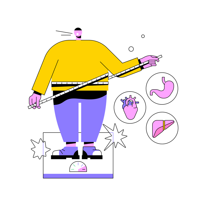 مزایای عمل بای پس معده