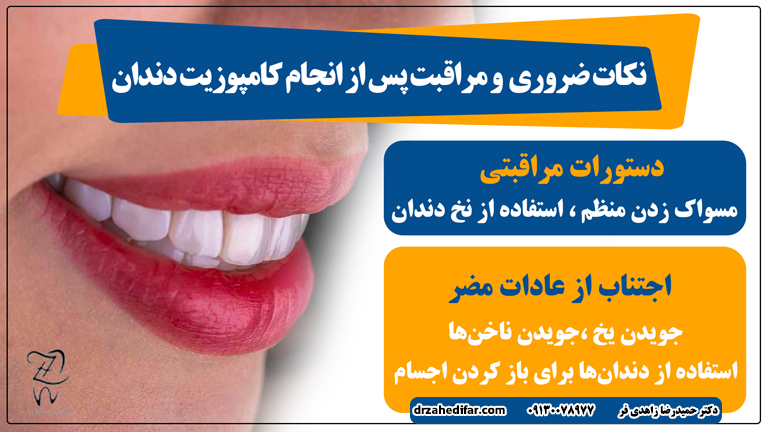نکات ضروری و مراقبت پس از کامپوزیت دندان