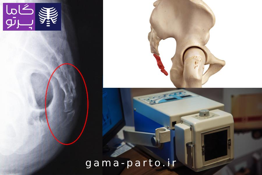 رادیولوژی در منزل گاما پرتو