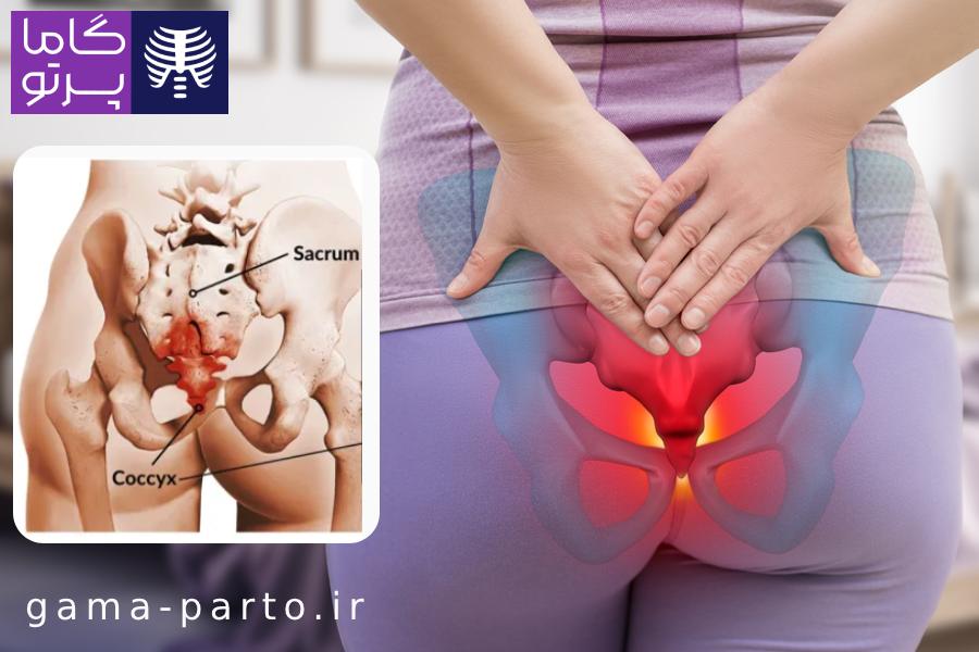 نشانههای رایج شکستگی استخوان دنبالچه - گاما پرتو