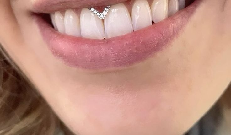 پیرسینگ اسمایل لبخند